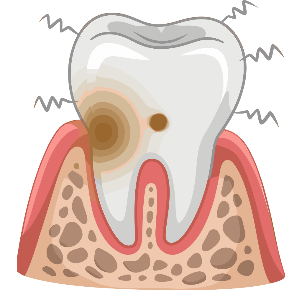 Emergency Toothaches