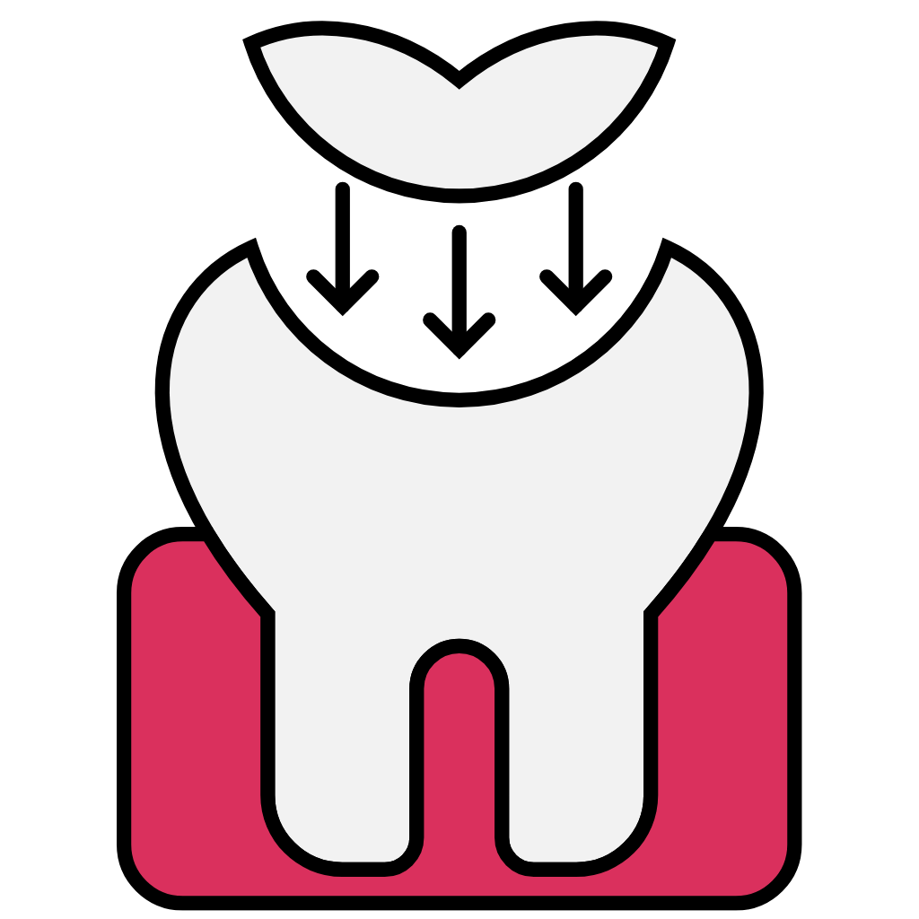 Lost Filling or Crown